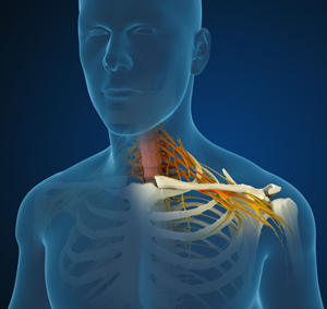  Cervical Radiculopathy/Myelopathy 