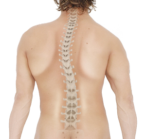 Scoliosis