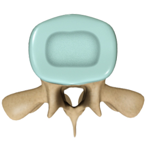 Spinal Stenosis